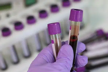 Researchers Find That a Blood Test Can Help Diagnose Mood Disorders